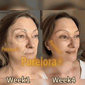 Bee Venom Skin Restorative Cream - Image 14