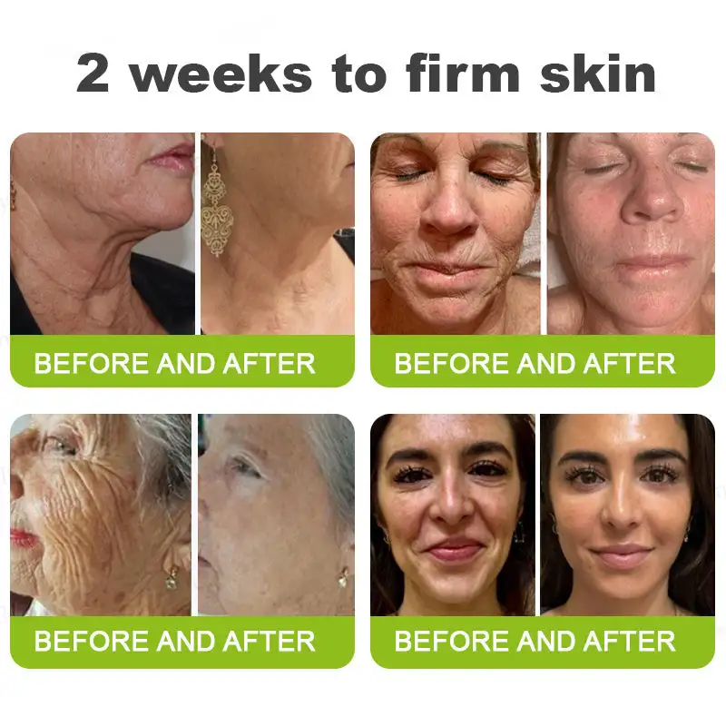 Botox Vitamin A Retinol Anti-Wrinkle Firming and Lifting Cream - Image 4