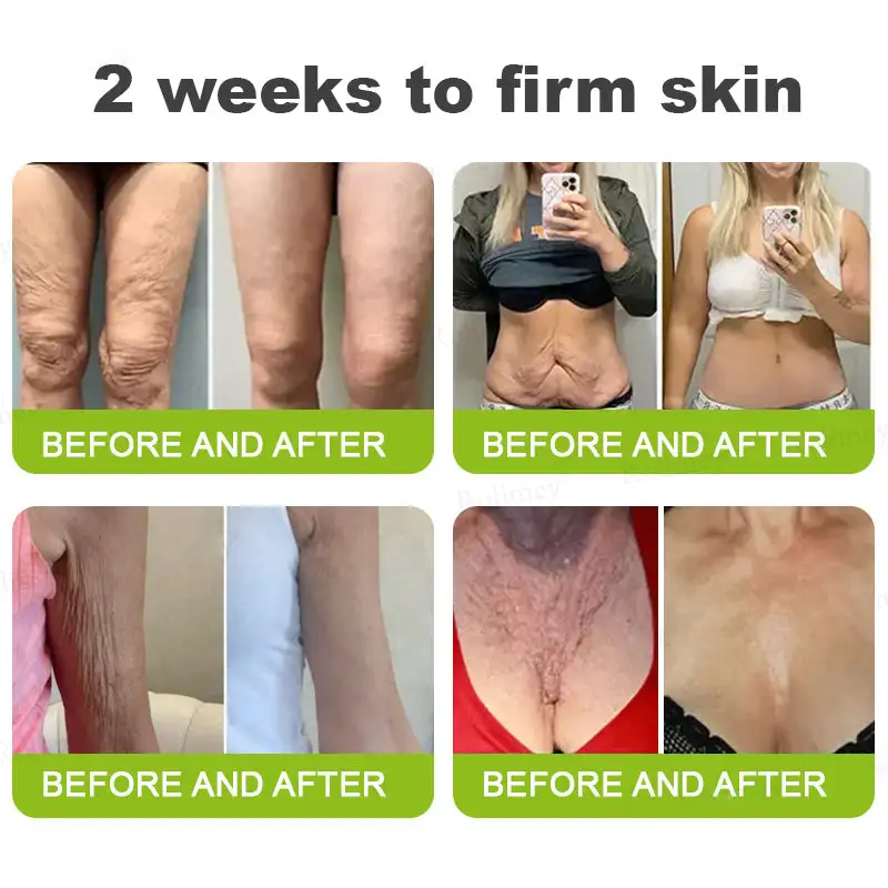 Botox Vitamin A Retinol Anti-Wrinkle Firming and Lifting Cream - Image 6