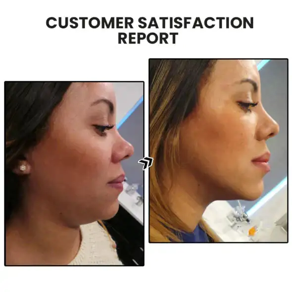 NESLEMY Lymphatic MagneTherapy Germanium Earrings - Image 11