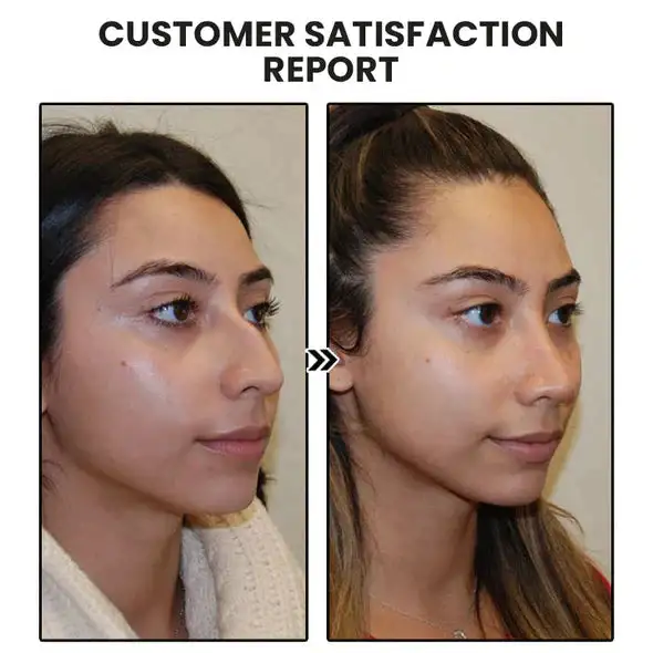 NESLEMY Lymphatic MagneTherapy Germanium Earrings - Image 12