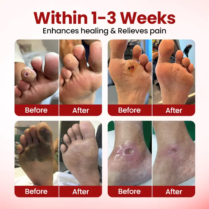 VitaGluco Diabetic Care Cream - Image 4