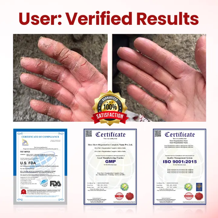 VitaGluco Diabetic Care Cream - Image 5