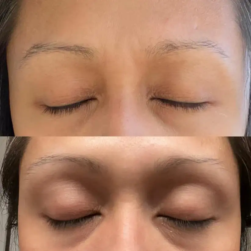 Organic Castor Oil Roll-On - Image 8