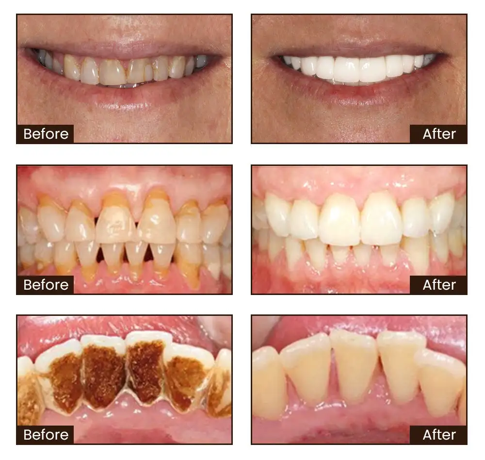 Niacinamide Whitening Toothpaste - Image 3