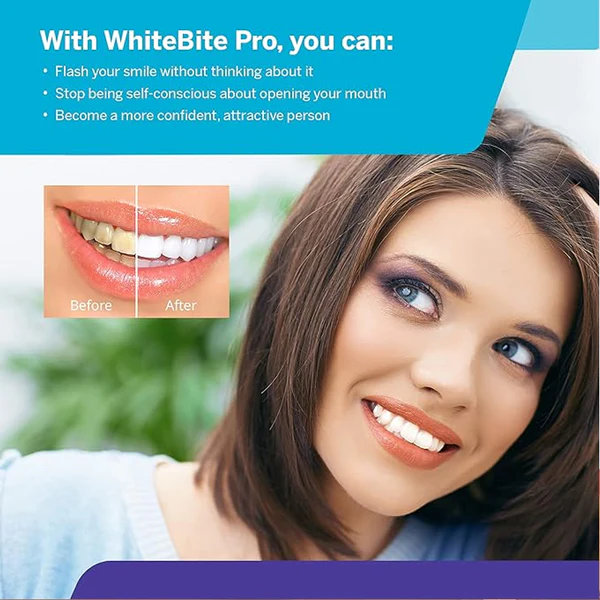 Teeth Whitening Kit with LED Light - Image 5