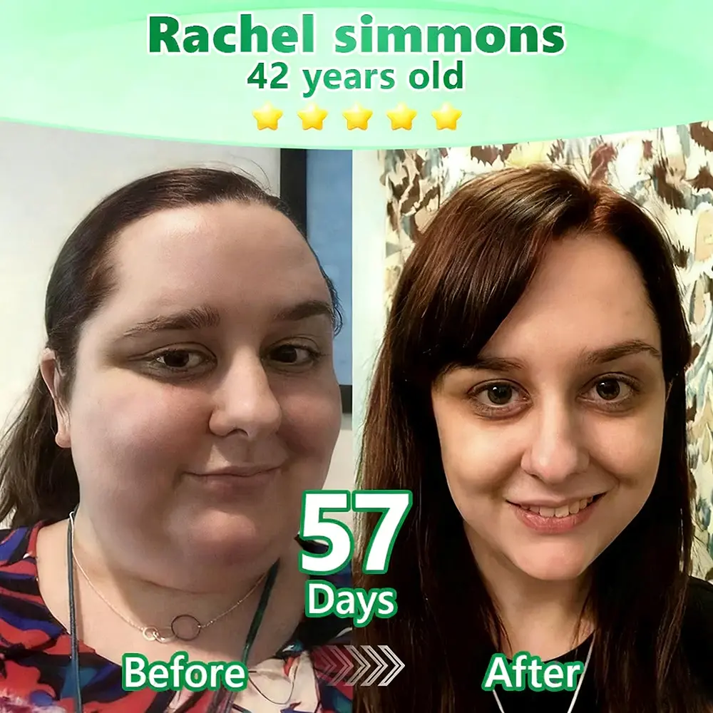 Slimming & Firming 2-in-1 Nano Microneedle Patchus - Image 2