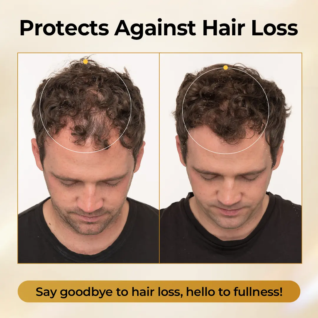 CollagenGrow Peptides Hair Growth Spray - Image 3
