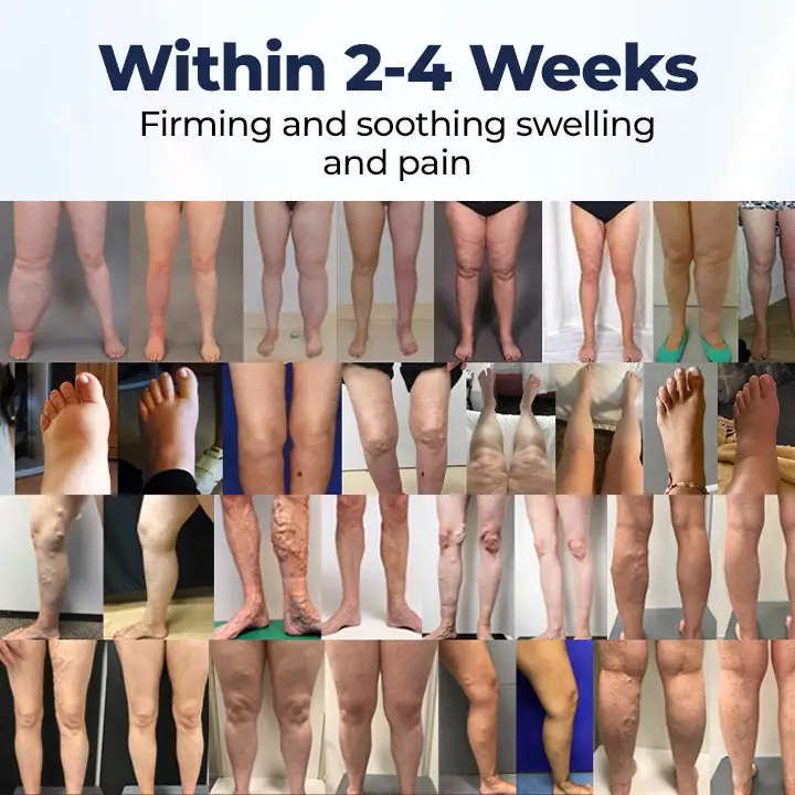 SwellRelief Circulation Support Cream - Image 2