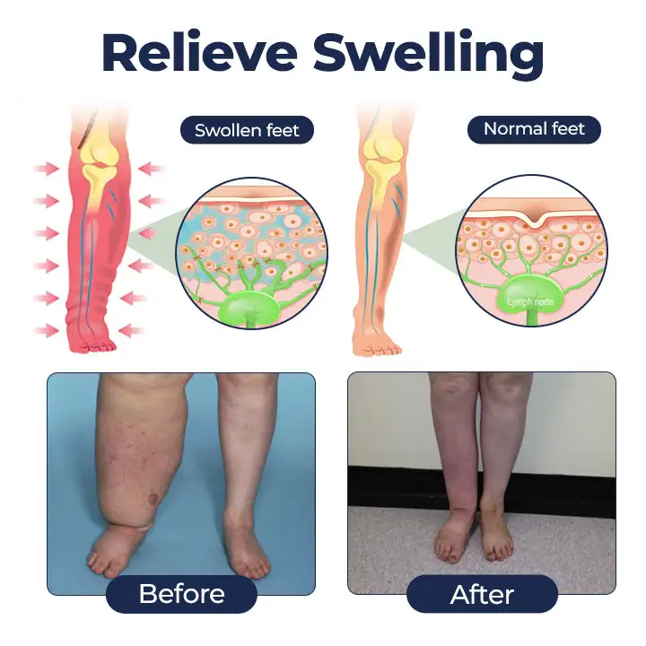 SwellRelief Circulation Support Cream - Image 5