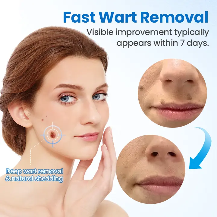 TagGone Wart Removal Cream - Image 3
