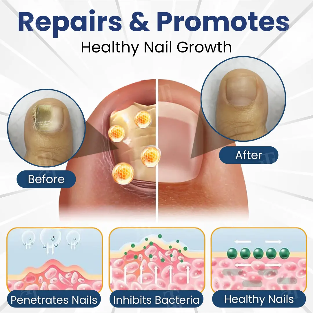 Bio-Active Deep Penetration System for Nail Fungus - Image 4