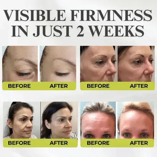 Botox & Vita-A Retinol Shot Wrinkle-Lift Tightening cream - Image 2