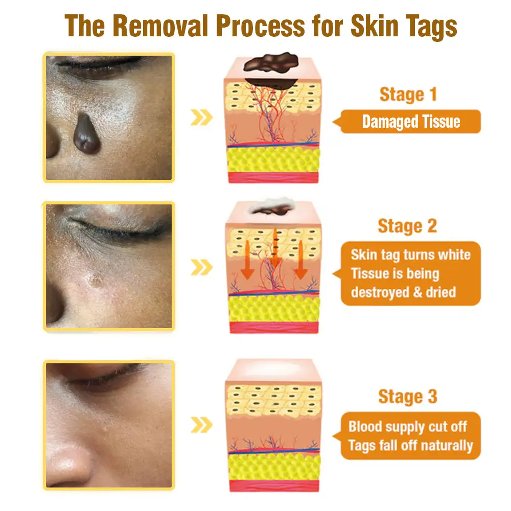 Bee Venom Tags Removal Cream - Image 6