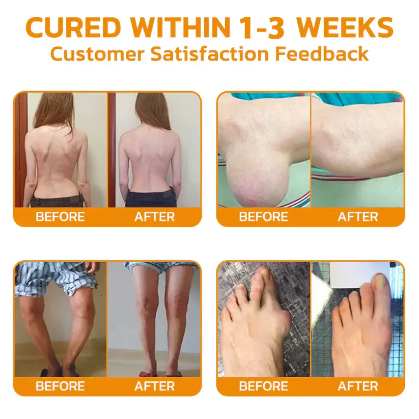 Lidocaine Fast-Acting Maximum Strength Pain Relief Liquid - Image 3