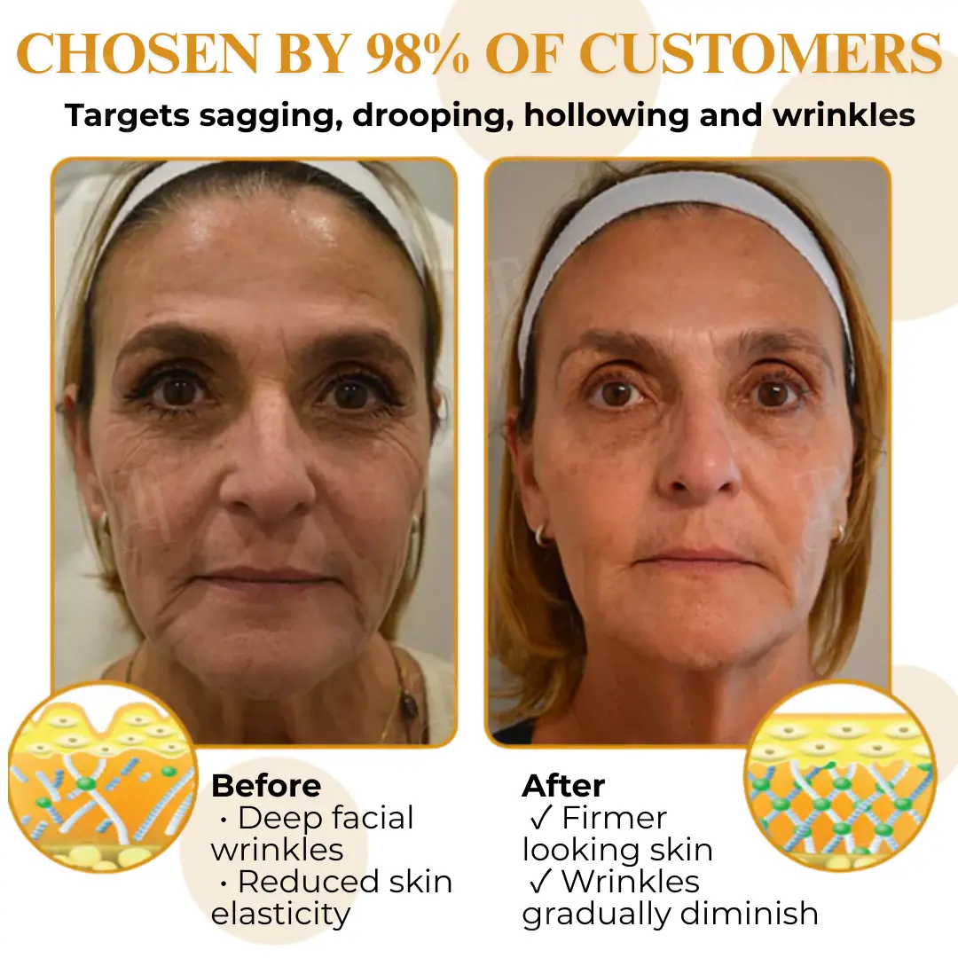 Letybo Bee Venom Wrinkle Removal Cream - Image 3