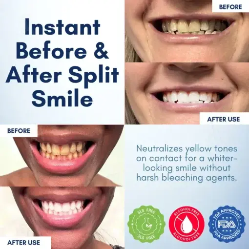 Pro-Bright Teeth Gloss – Instant Radiant Smile - Image 2