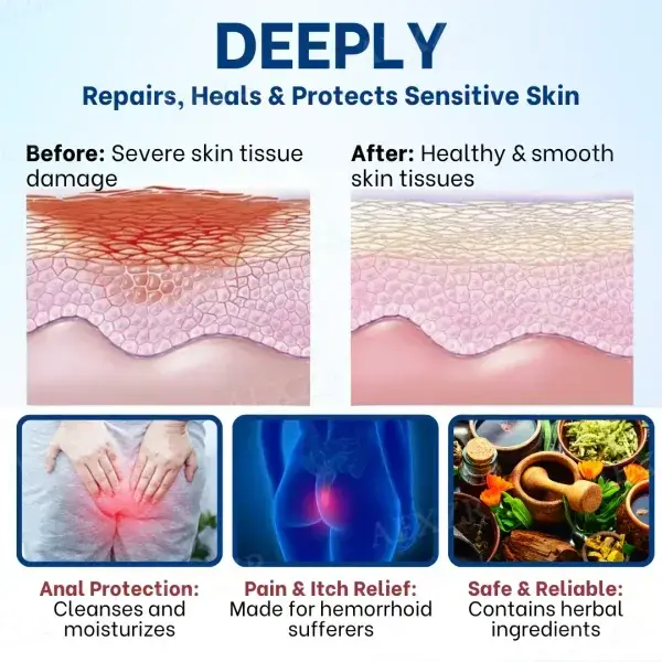 Pruritus Ani Treatment Cream - Image 4