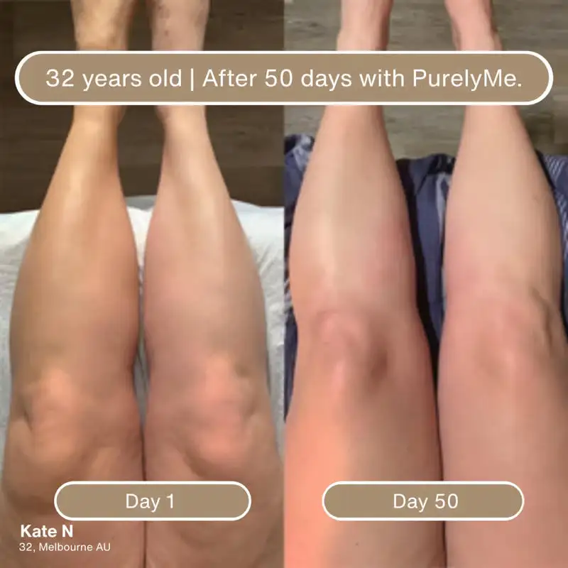 Collagen-Infused Body Oil • Deep Hydration + Firming Feel - Image 5