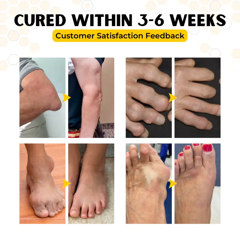 OrthoRestore Bee Venom Joint Relief Cream - Image 7