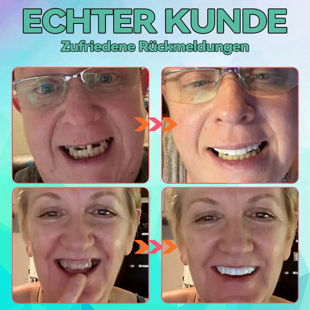 Silikon Reline Gebiss-Set - Image 2