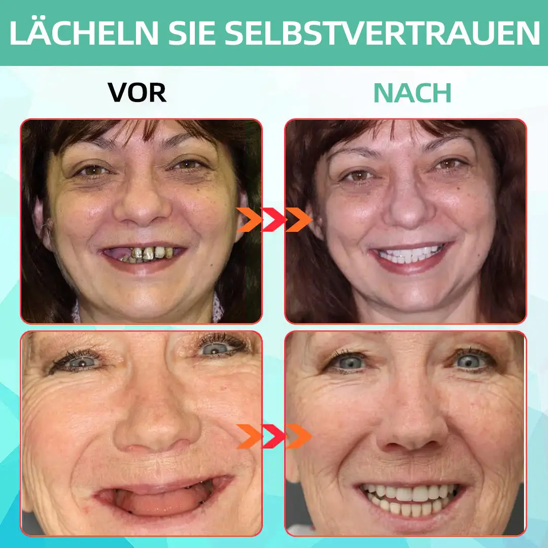 Silikon Reline Gebiss-Set - Image 3