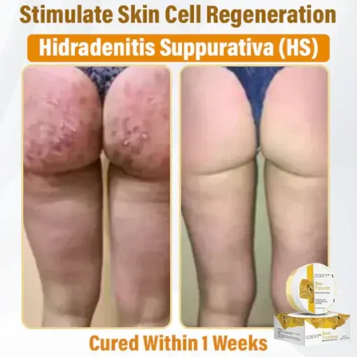 Bee Venom Skin Renewal Cream - Image 2