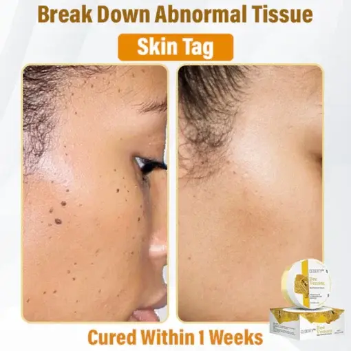 Bee Venom Skin Renewal Cream - Image 4