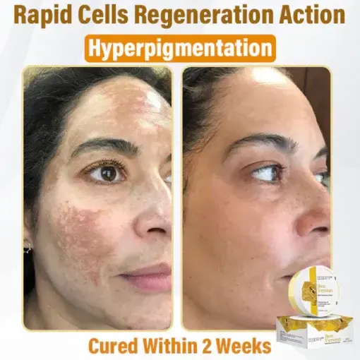 Bee Venom Skin Renewal Cream - Image 8