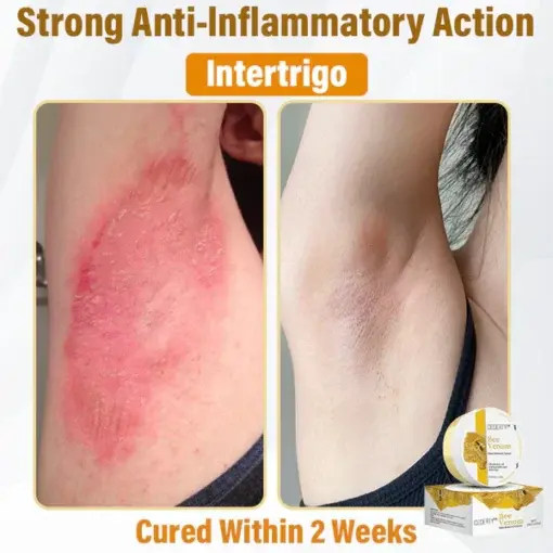 Bee Venom Skin Renewal Cream - Image 9