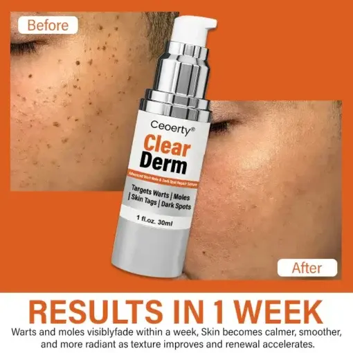 ClearDerm Advanced Wart Mole & Dark Spot Repair Serum - Image 7