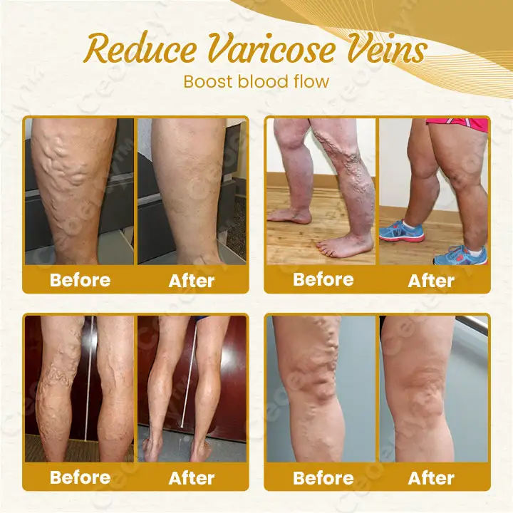 DetoxiSlim Foot Bath Beads - Image 6