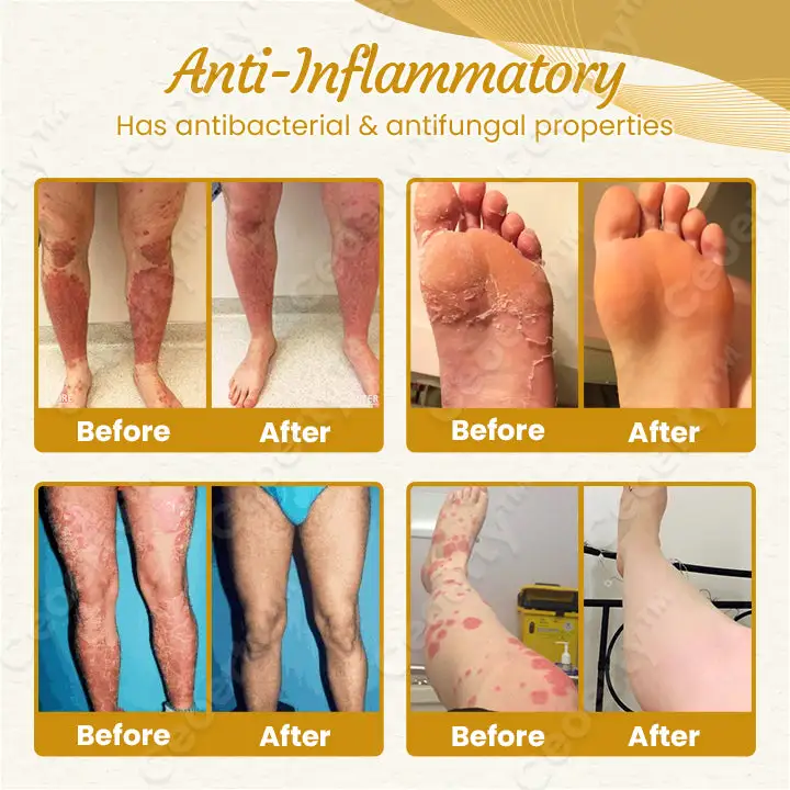 DetoxiSlim Foot Bath Beads - Image 8