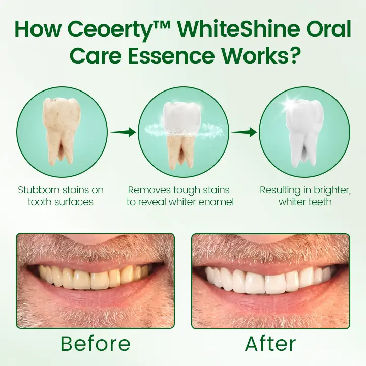 WhiteShine Oral Care Essence - Image 2