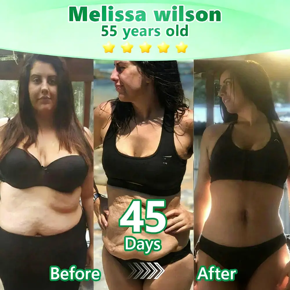 Caffeine · L-Carnitine × Retinol | Slimming & Firming 2-in-1 Nano Microneedle Patch - Image 4