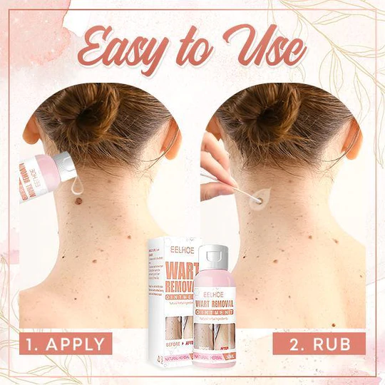 Herbal Wart Skin Removal Ointment - Image 10