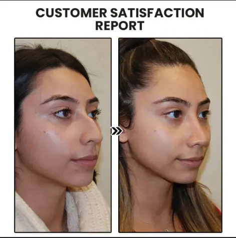 Miniyou Lymphatic Drainage Earrings - Image 10