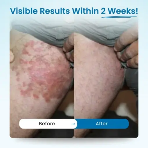 – Mens GentCare Relief Cream - Image 7