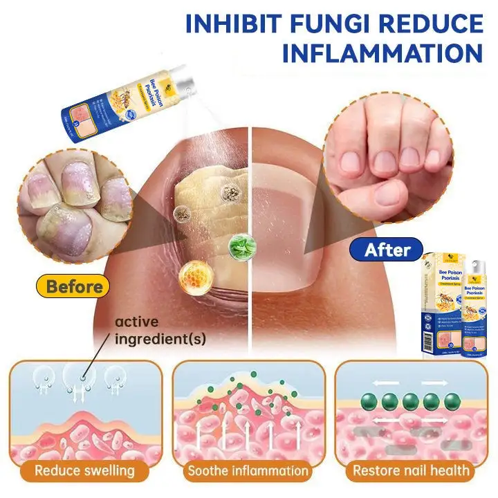 PsoriaHeal psoriasis Spray pro - Image 9