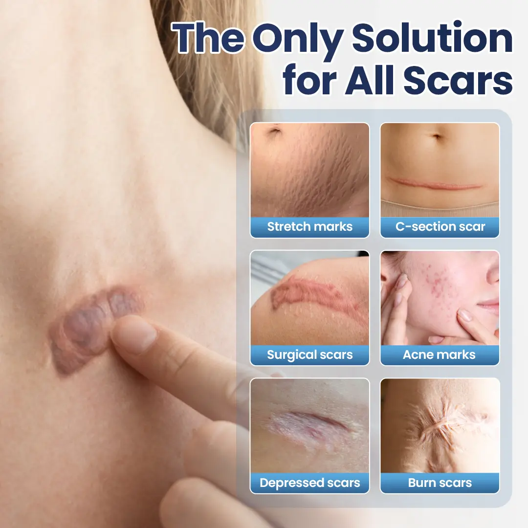 Texture Repair Gel - Image 2