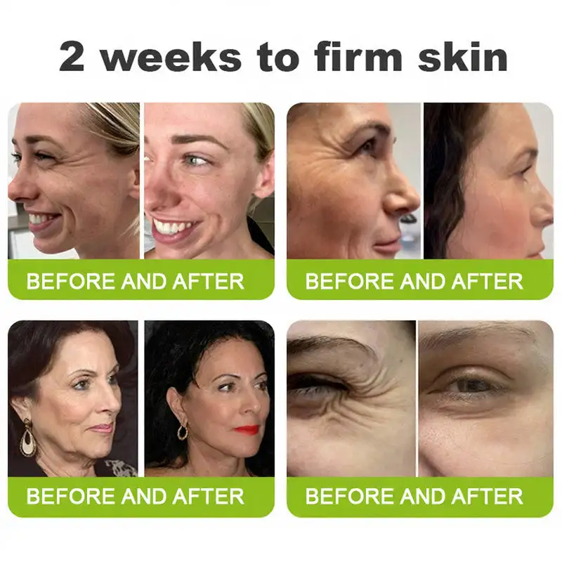 Wrinkle-Lift Tightening Cream | See firmer, smoother skin in as little as 3 days - Image 6