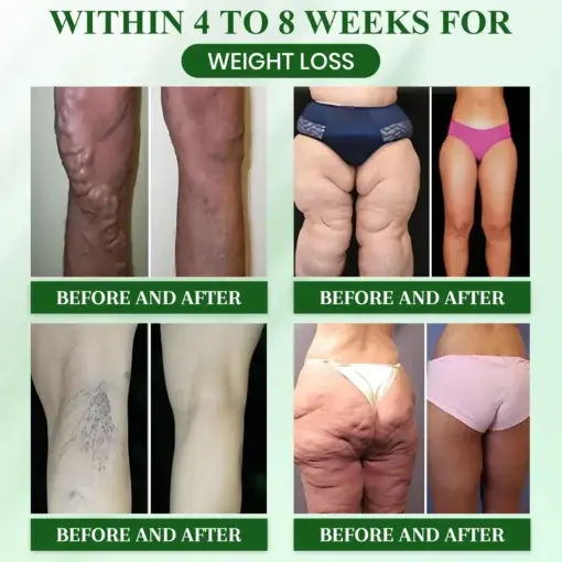 Slimming Oral Drops - Image 4