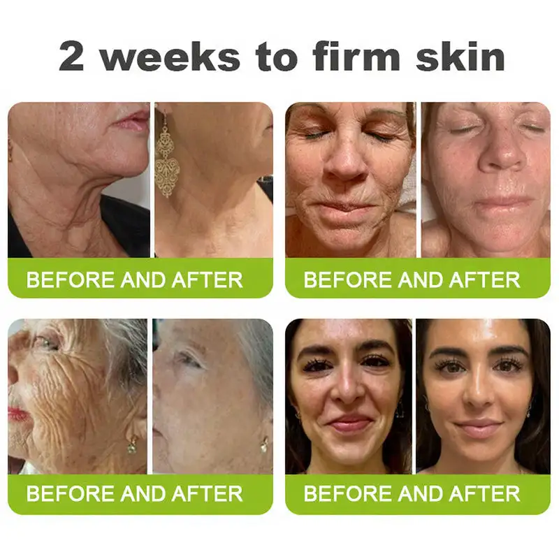 🧠👨⚕️Made and shipped from the USA Skin Tightening & Vita-A Retinol Retinol shot Anti-Wrinkle Firming Tightening cream - Image 7