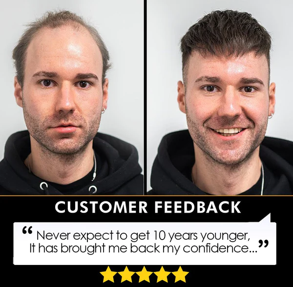 Men's Hair Topper - Image 4