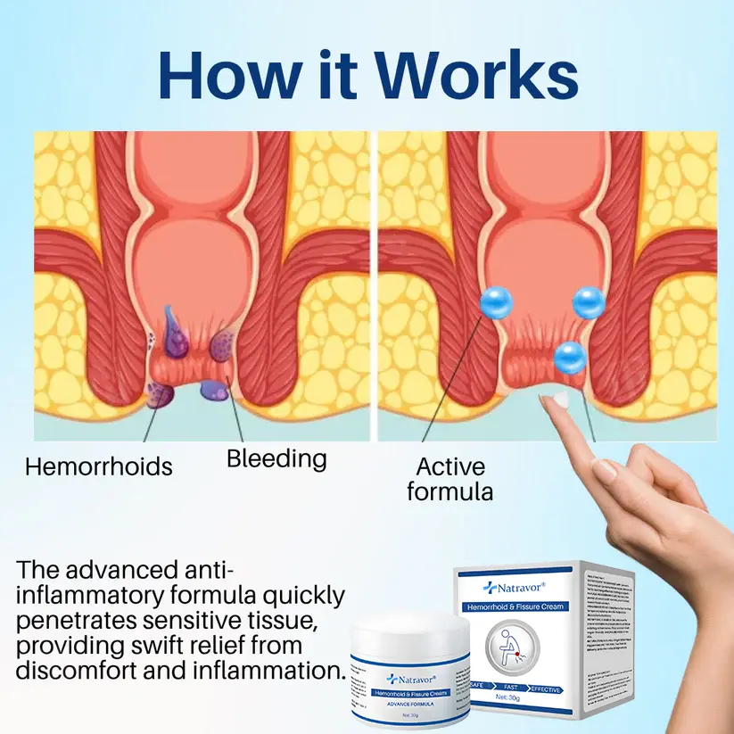 ๐๐ฒ๐บ๐ผ๐ฟ๐ฟ๐ต๐ผ๐ถ๐ฑ & ๐๐ถ๐๐๐๐ฟ๐ฒ ๐๐ฟ๐ฒ๐ฎ๐บ - Image 5