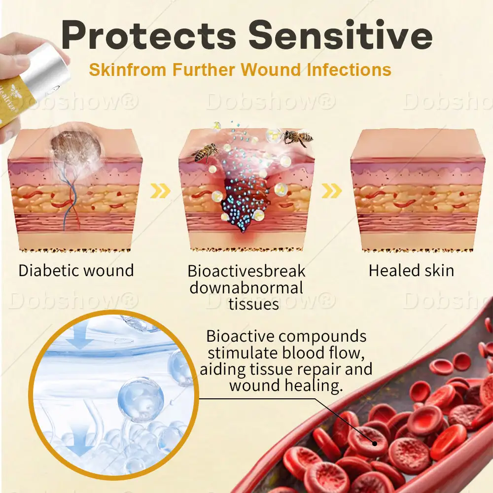 New Year Special Offer 🎊| GlucoShield Bee Venom Wound Spray - Image 4