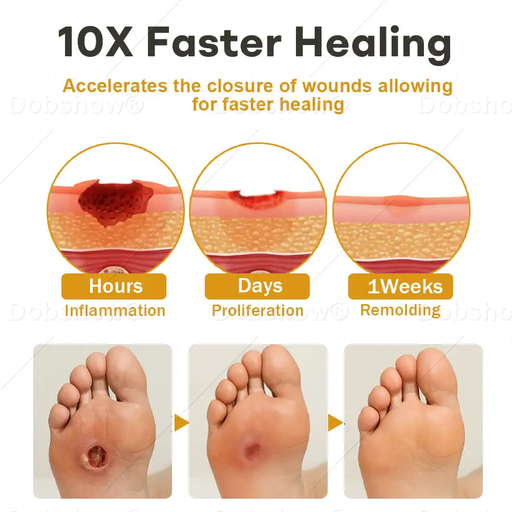 New Year Special Offer 🎊| GlucoShield Bee Venom Wound Spray - Image 6