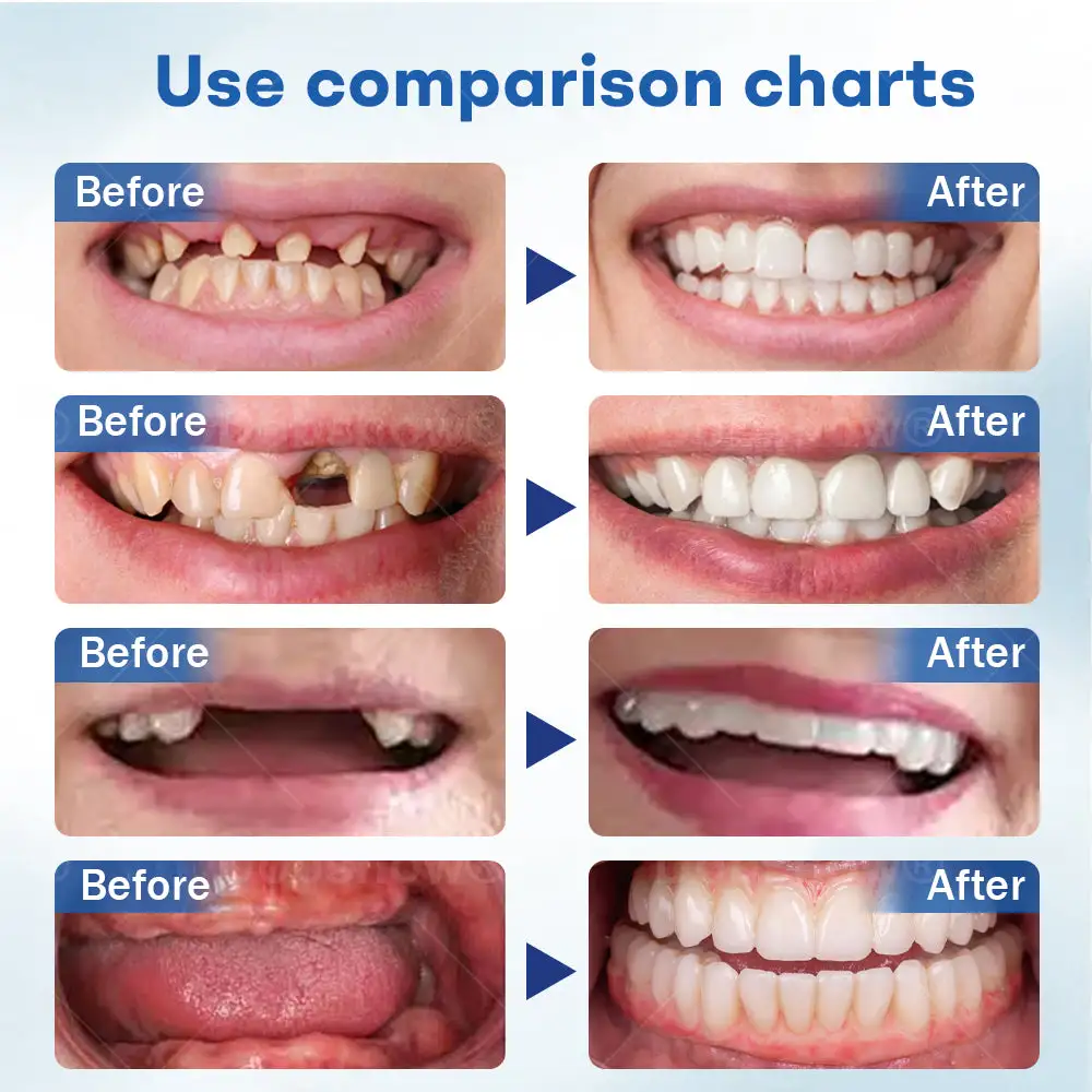 ThermoSeal Fresh Denture - Image 3