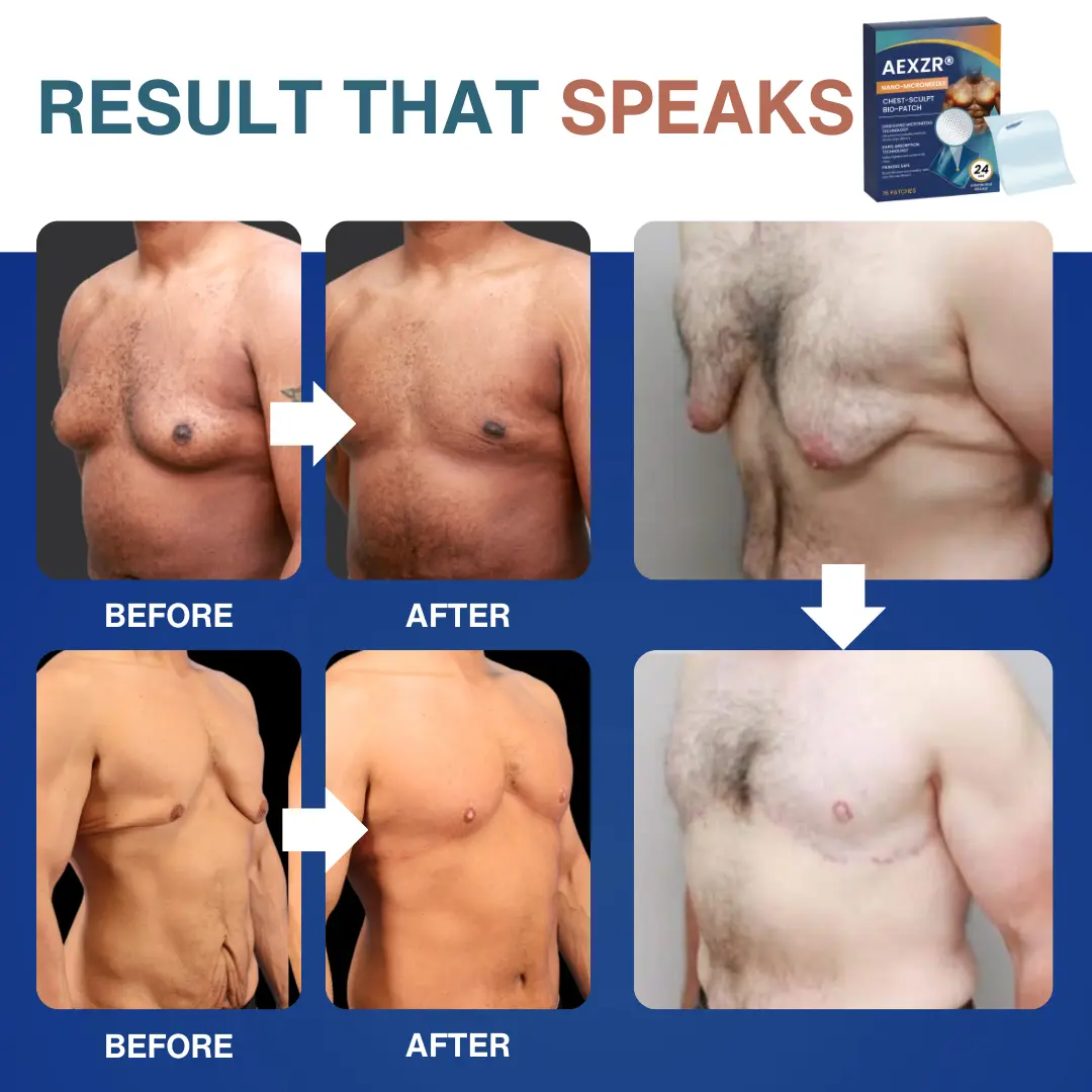 Nano-Microneedle Chest-Sculpt Bio-Patch - Image 3