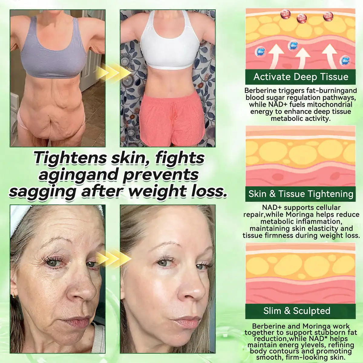 𝐍𝐌𝐍 𝐁𝐄𝐑𝐁𝐄𝐑𝐈𝐍𝐄 𝐱 𝐍𝐀𝐃 𝟐𝟎-𝐢𝐧-𝟏 𝐀𝐝𝐯𝐚𝐧𝐜𝐞𝐝 𝐍𝐚𝐧𝐨 𝐌𝐢𝐜𝐫𝐨𝐧𝐞𝐞𝐝𝐥𝐞 𝐏𝐚𝐭𝐜𝐡 - Image 5